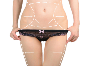 liposuzione rimodellamento chirurgo plastico
